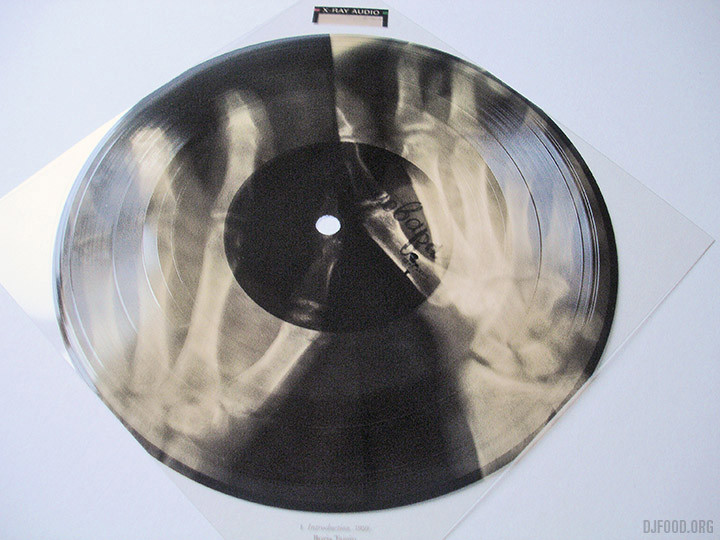 X-Ray AudioBookFlexi