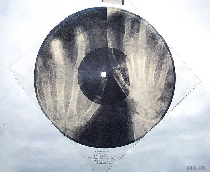 X-Ray AudioBookFlexi2